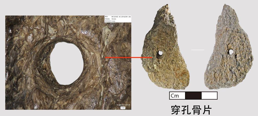 穿孔骨片