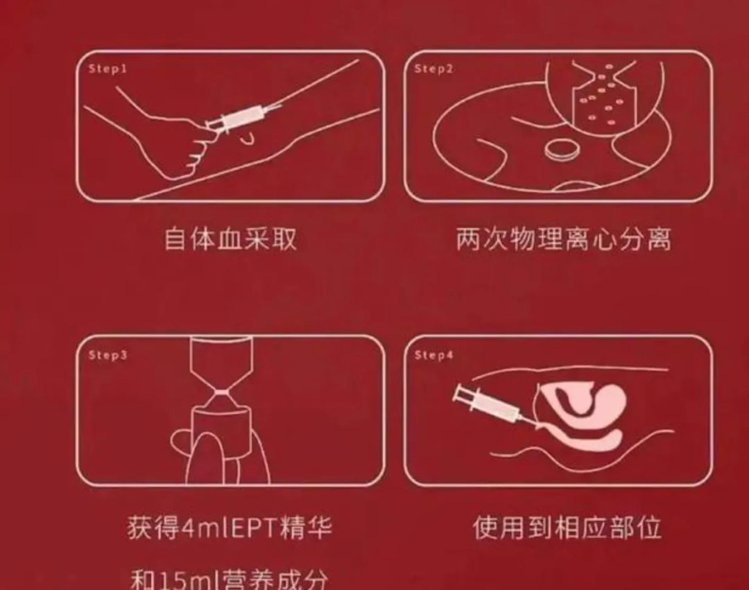 专坑女人的“隐秘陷阱”，把戏被戳破了