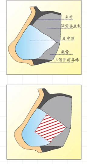△红色为取材位置