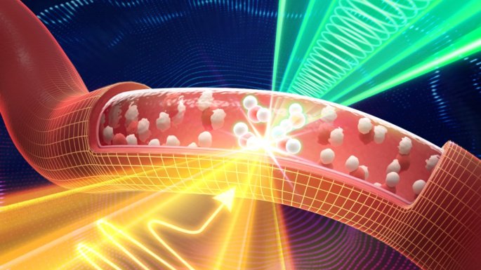 太赫兹光声检测取得新突破 太赫兹和声波结合使无针血钠检测成为可能