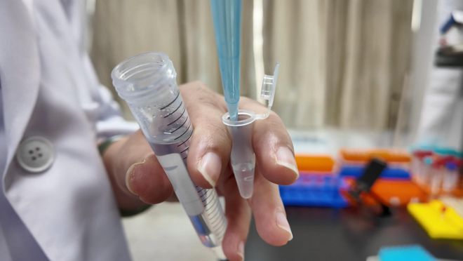 氨基酸是什么提取出来的 0cdb-1cb53b009c73b020507faddcb6414e9b.jpg