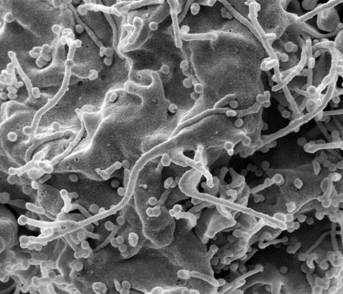 图片来源:Steve Gschmeissner/Science Photo Library