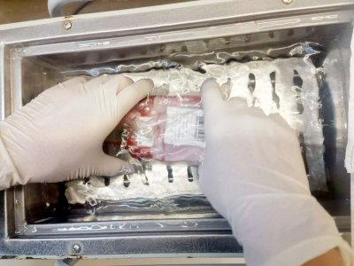 冻存13年后 成都好人捐赠的脐带血赴闽救人