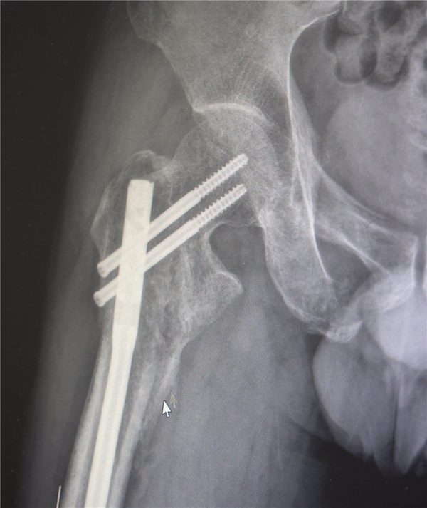 部分手术后拍摄的影像