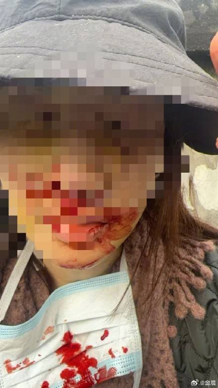 定了！国内知名女星金晨肇事逃逸被罚1500元 不构成犯罪