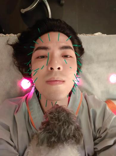 萧敬腾做针灸，脸上扎了数十支针，网友：看照片，脸疼