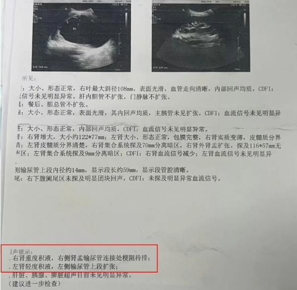 △城城在当地的检查报告