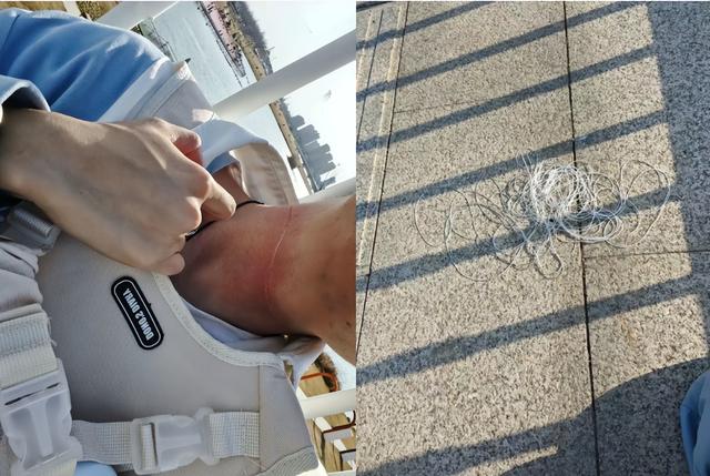 惕！男子骑摩托过桥时被割脸，“凶器”又是它