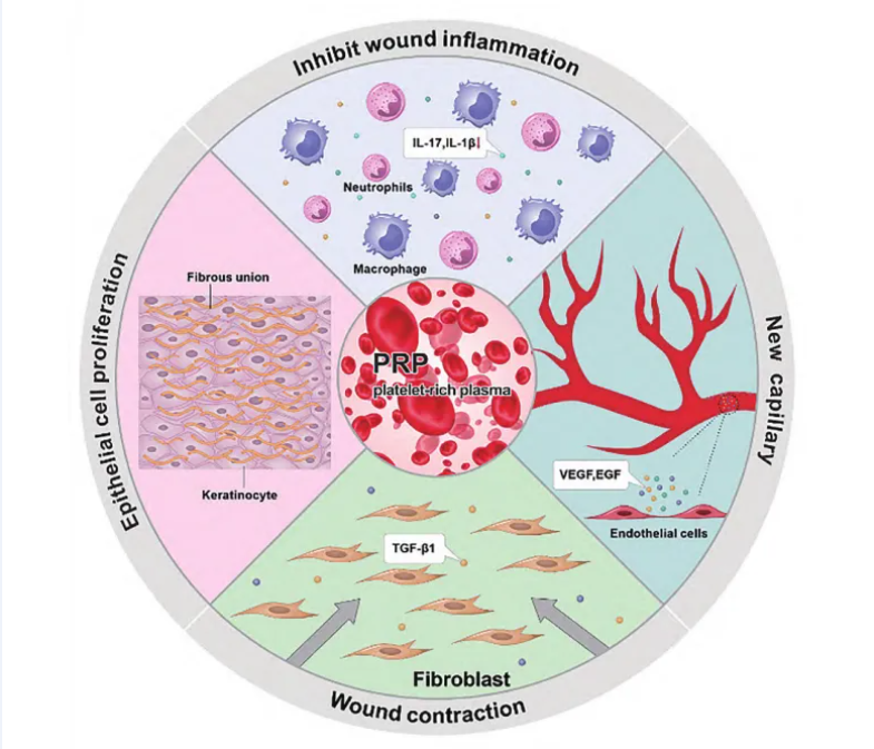PRP在创伤修复中的机制示意图
