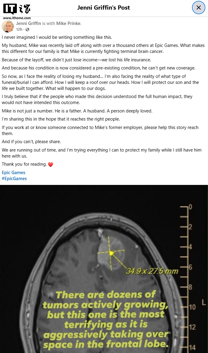Epic 裁员超千人致患癌员工失去保险，家属发声求助