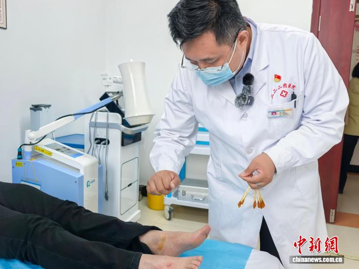 潘誌強正在為患者針灸。胡健 攝