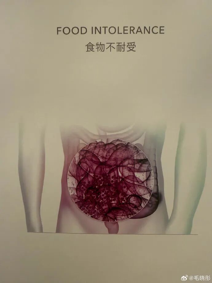 毛晓彤晒医院检测报告，并配文：作为一个从小爱吃面食的天津人，查出面粉不耐受可怎么办