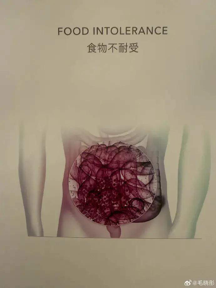 演员毛晓彤凌晨从医美诊所离开引网友热议，其晒医院检测报告回应：作为一个从小爱吃面食的天津人，查出面粉不耐受可怎么办