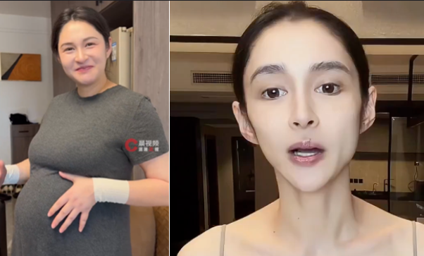 36岁女演员从175斤到暴瘦脱相！颧骨突出、双颊凹陷，网友惊呼“不敢认”，担忧其健康状况