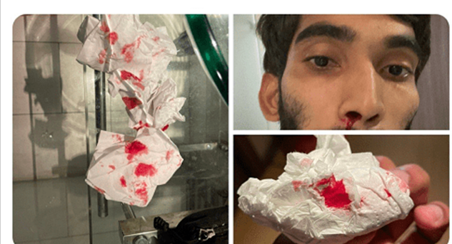 Re: [情報] FIBA因不配合亞洲盃賽事罰款籃協並記點