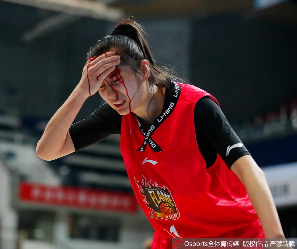 受伤后的郭子瑄在队医和队友的搀扶下缓缓走向场边，她用手捂着头部的伤口，但神情依然坚毅，不甘就这样离开赛场。