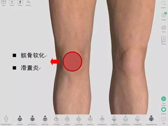 膝盖不同位置疼痛对应的可能病症 或与跑姿跑量