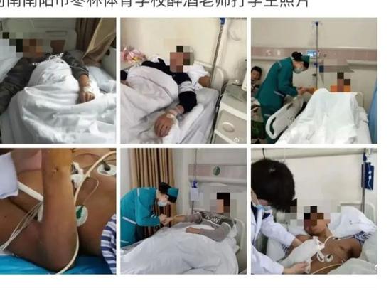 10月19日,骨折的篮球队队员仍在医院治疗。