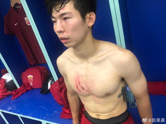 图说：杨世元的受伤照赛后被晒出。