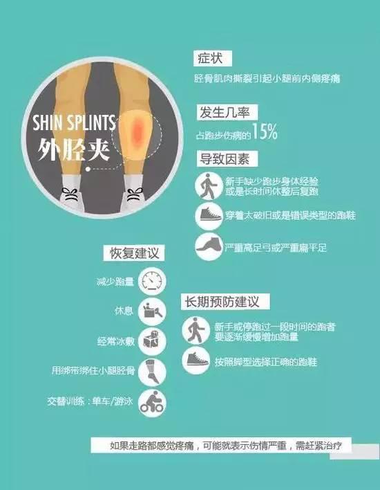 外胫夹也可以叫做胫骨应力综合症,是胫骨内侧的受压迫的综合病症,一种由于胫骨肌肉撕裂引起的疼痛。