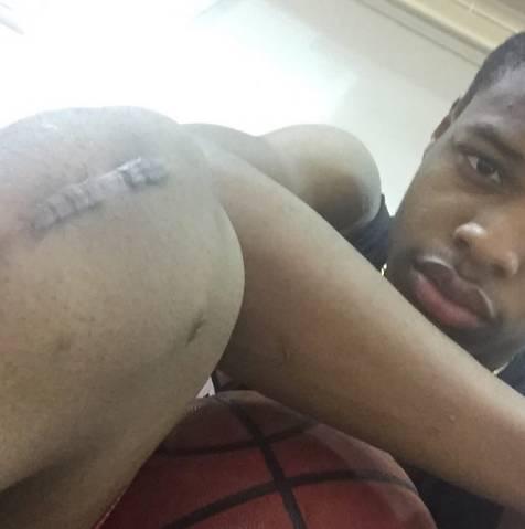 逆天扣將!勁爆新秀膝蓋韌帶撕裂後反而跳得更高!-黑特籃球-NBA新聞影音圖片分享社區