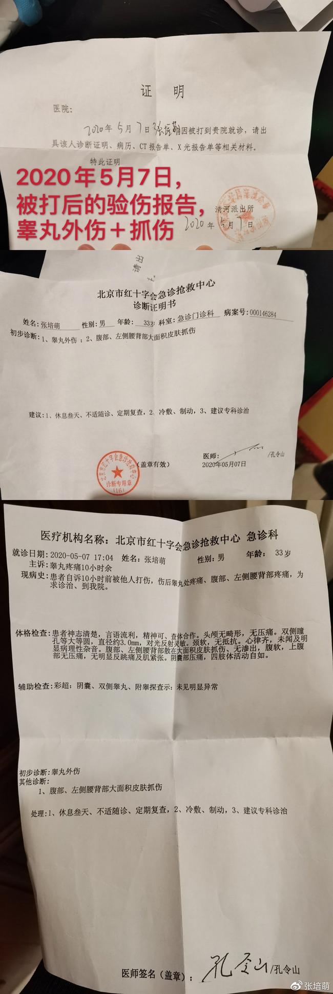 张培萌列举张莫涵施暴罪证：睾丸曾被抓伤