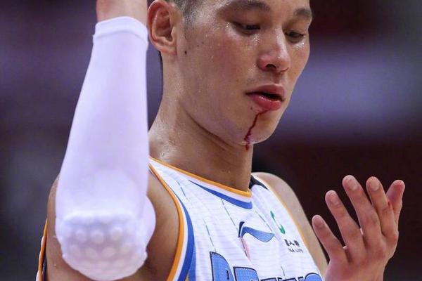 阿内尔卡-乐鱼app(leyu)官方网站-乐鱼官网