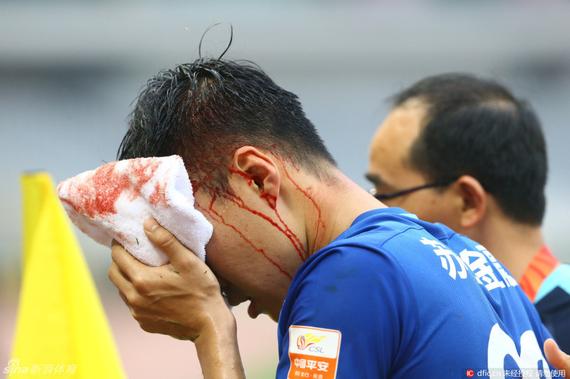 吴曦受伤恐无法出战富力