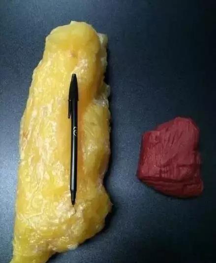 ҲϮ Ӽʴ57KG57KG