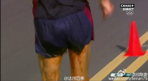 迪尼兹在比赛途中大便失禁