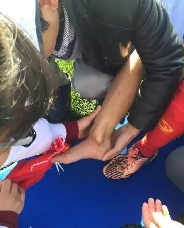 女足黑妹的故事脚受伤严重变形绝杀宣告归来