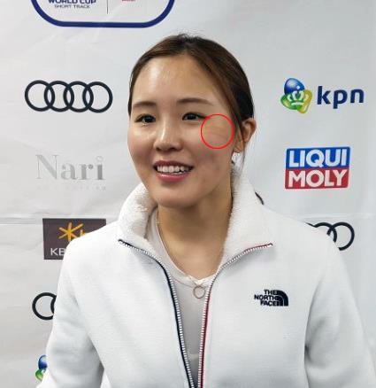 韩国短道速滑女将不惧"毁容" 盼卫冕接力赛