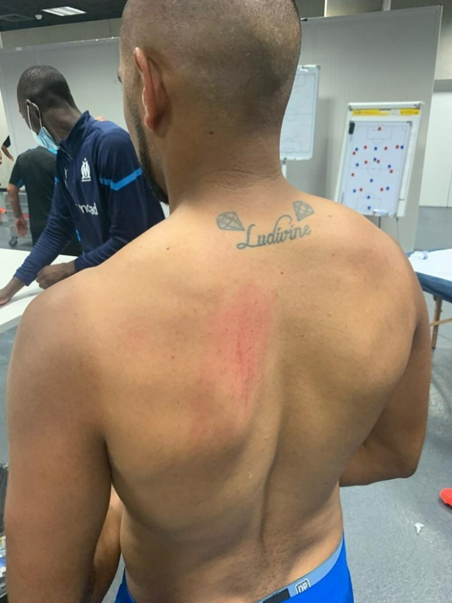 【博狗扑克】马赛3名球员在球迷骚乱中受伤 伤痕清晰可见(图)