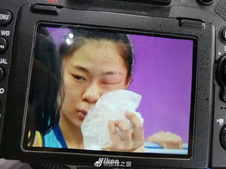 刘立雯眼角肿了起来