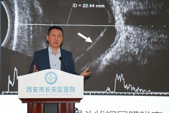 西安市中心医院杜兆江教授
