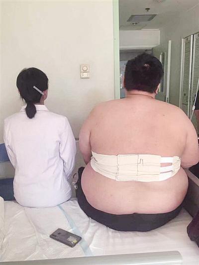 李宏（化名）手术前体重达396斤 本报记者 李海涛 摄