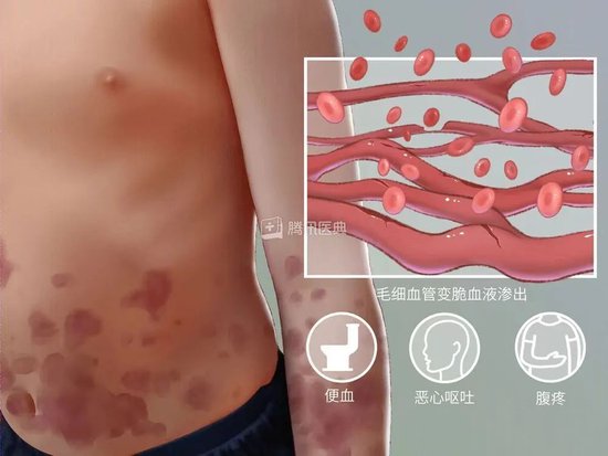 图源：腾讯医典