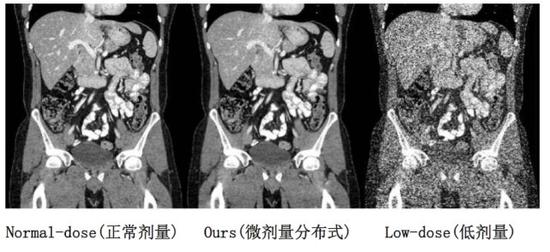 微剂量分布式CT在西安交大二附院进行二期临床应用结果 (2020年9月)