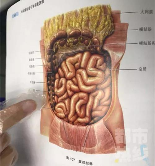 据了解,磁力珠在小哲体内串成了圆环,吸附在肠道上,根本无法排出。