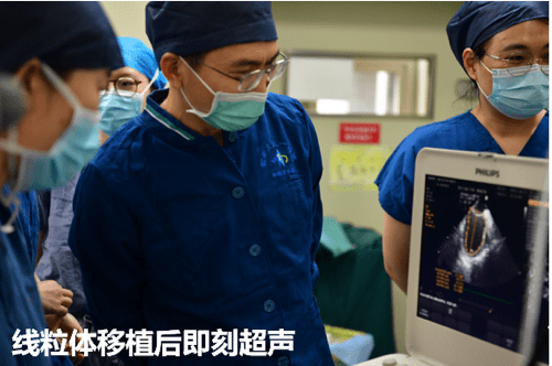 图5.术中自体血小板线粒体移植