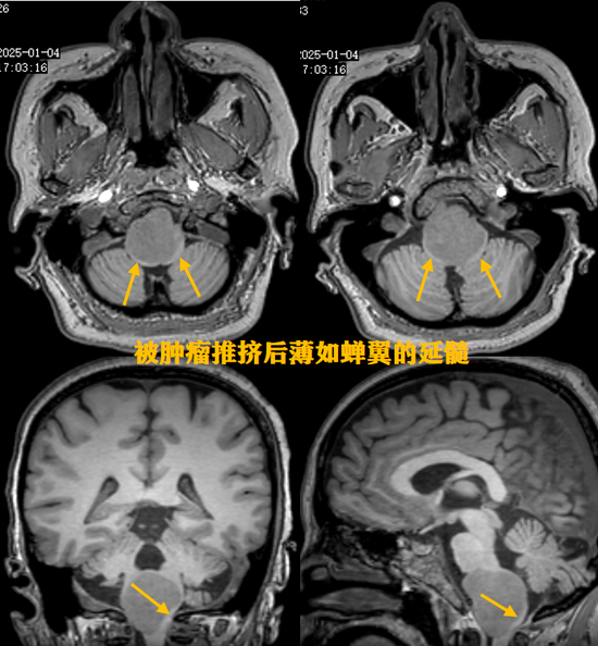 术前影像资料