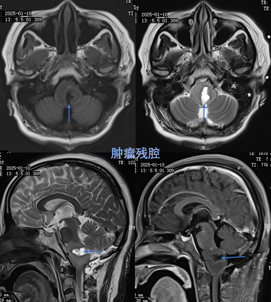 术后影像资料