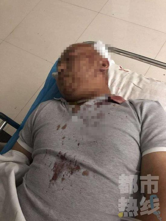 和朋友吃飯，誰知小劉和他的朋友竟然遇上了這樣的事！