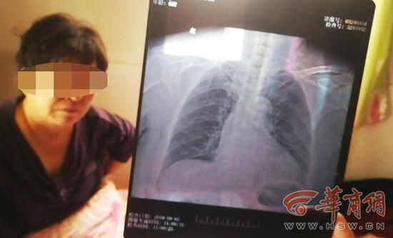 ●杨先生说:“我回过头,发现一位老太摔倒在地,我离她有约20米远”