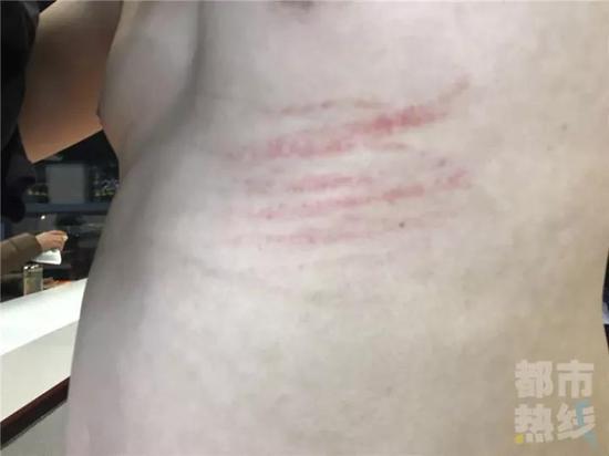 (記者被打照片)