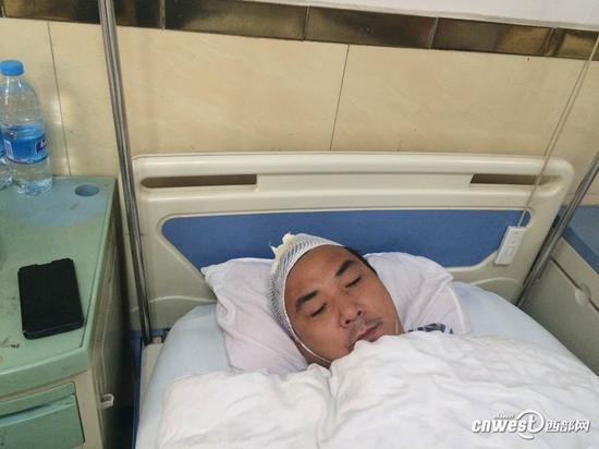 男子大白天和妻子閑逛 卻莫名遭陌生人棍棒群毆