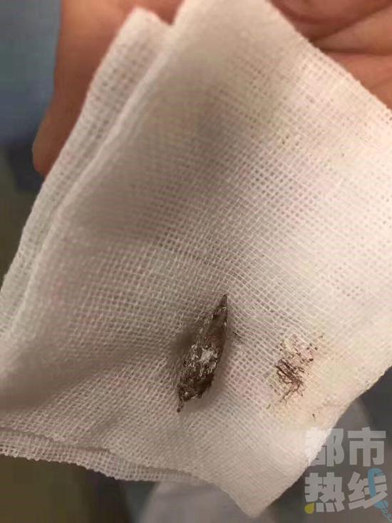 端午节取枣核