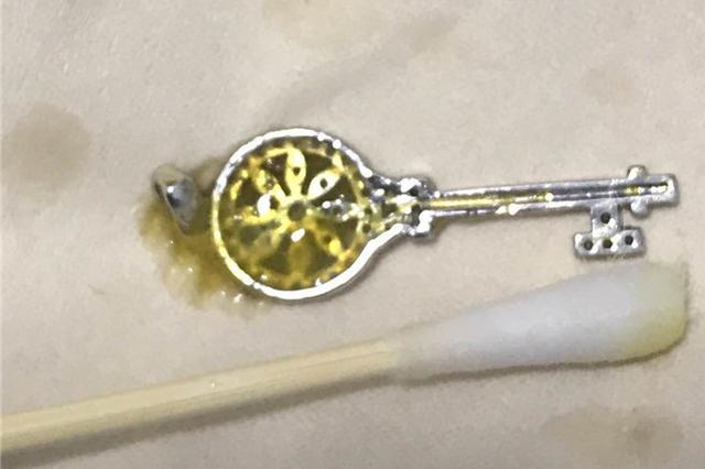 谨防儿童吞食异物 三个月大女婴被哥哥喂下银钥匙