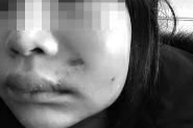 安康28岁女子做人造酒窝 针头竟然断在面颊里