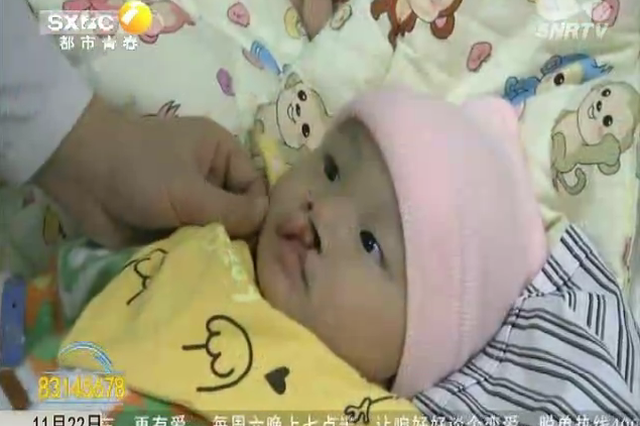 四个月大娃重度唇裂 妈妈哭诉“我很难受”